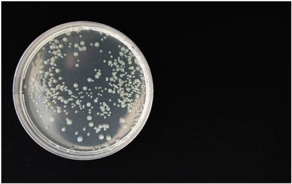 Piastra di coltura per analisi microbiologiche